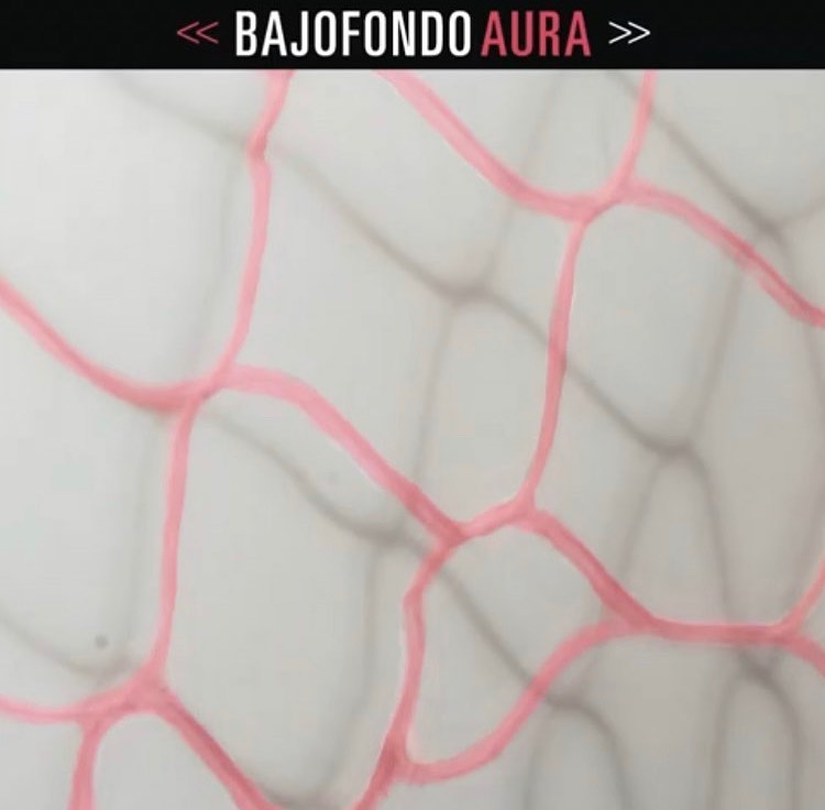 Aura